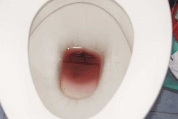 Spotting in men when they are aroused